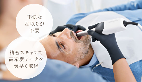 不快な型取りが不要、精密スキャンで高精度データを素早く取得